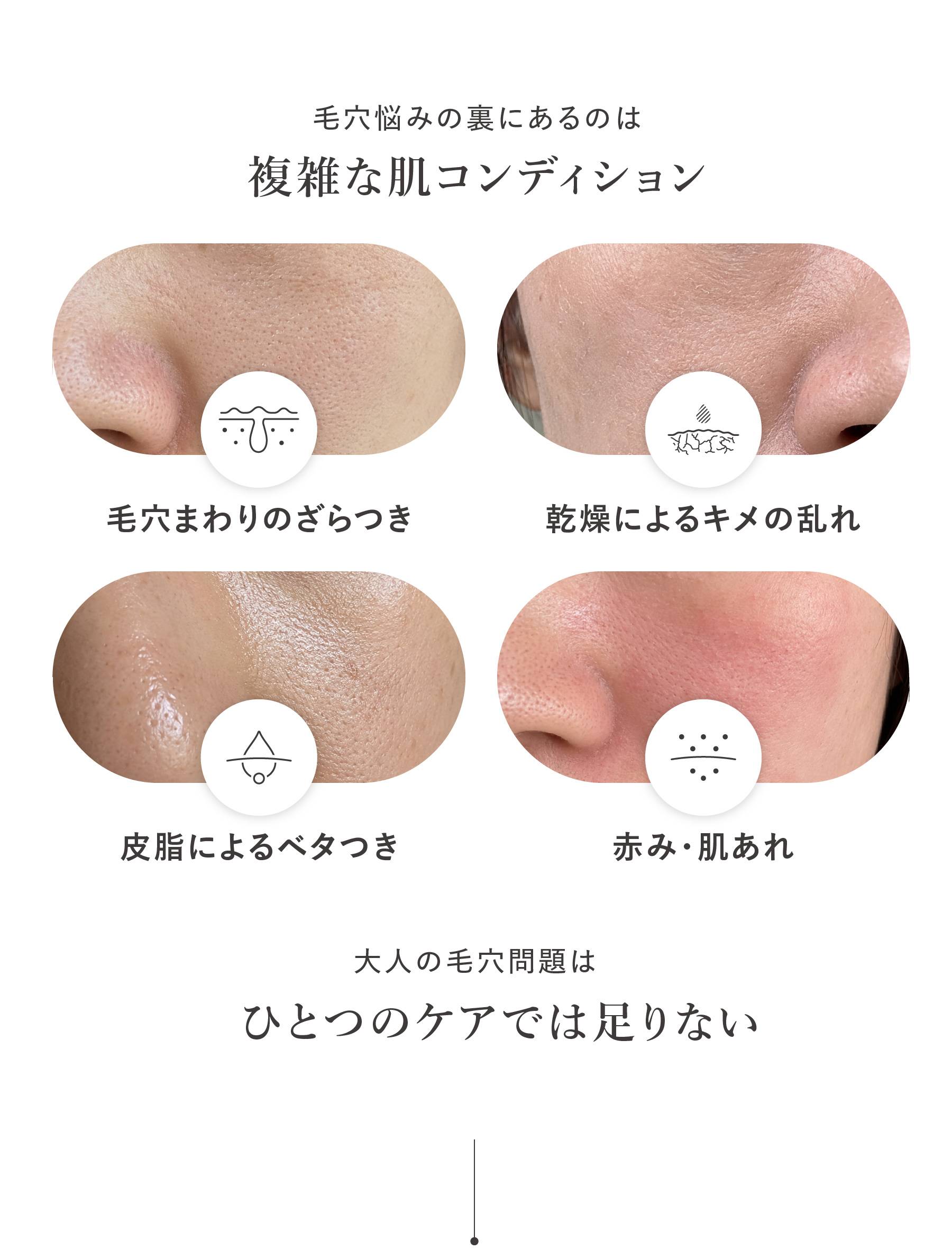 毛穴,ざらつき,皮脂